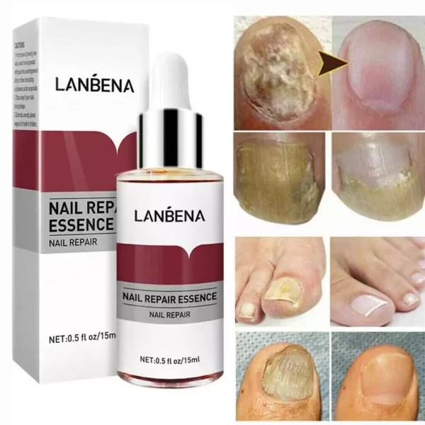 Lanbena Nail Care Gellanbena nail repairhow to use lanbena nail repair essence how to use lanbena skin care gel how can i restore my nails after gel polish uv gel nails near me uv hard gel nails near me breaks between gel manicures lamisil cream during pregnancy brisa gel nails near me nail gel lamp near me lanbena near me what do you put on gel nails after top coat how to use lanbena nail care gel nail breaking under gel bio gel nails vs uv gel nails uv gel nails vs gel nails gel nails vs gel polish gel price in lanbena nail repair review lanbena nail repair lanbena near me lanbena cream price in bangladesh b nail supply lanbena nail repair essence price g nail spa prices g nails prices h-e-b nail salon prices h nails prices k nail prices q nail price list q nail prices q nail salon prices q nail salon near me t nail prices t gel nail supply t gel nail u nails prices v nail prices v nail near me v nail supply v nails lakeland tn w nail bar prices x gel nails near me x nails lakeland tn x-enail replacement parts yen nails prices z nail prices z nails price list 1 nail supply 1 nails prices 1 nail pro la nails 2 prices lanbena 24k gold peptide serum 3l nails prices 4ever nails price list 4ever nails prices lanbena nail 8-penny nail 88 nail supply